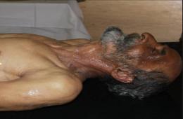 An Old Man Died Due to the Siege on the Yarmouk camp, Raises the Siege Victims’ Toll to 173 Victims