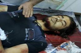 A Palestinian Refugee Dies due to shelling at Al Sad road Southern Syria