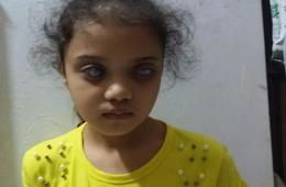 Palestinian Child with Congenital Cataracts Left without Treatment in Syria