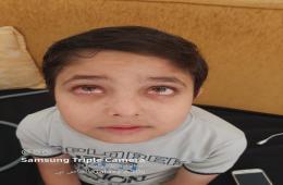 Palestinian Refugee Child in Need of Urgent Treatment in Turkey