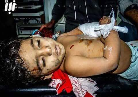 طفلة فلسطينية تقضي إثر استهداف مخيم درعا بقذائف الهاون 