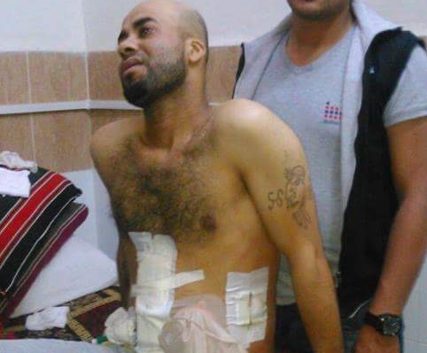 لاجئ فلسطيني يقضي بجراح أصيب بها جراء سقوط برميل متفجر على مخيم درعا قبل أشهر 