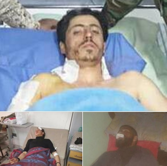 إصابة عدد من اللاجئين من مخيم النيرب في حلب أثناء قتالهم إلى جانب قوات النظام 