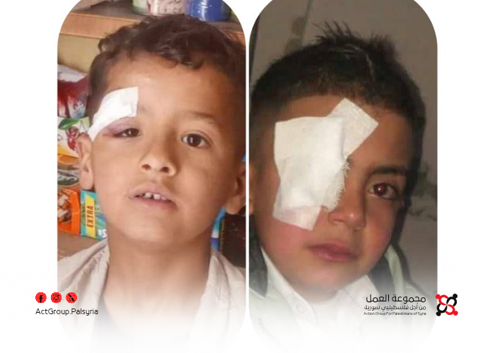 بعد إصابة أطفال في مخيم النيرب. تحذيرات من خطورة الألعاب في المخيمات الفلسطينية