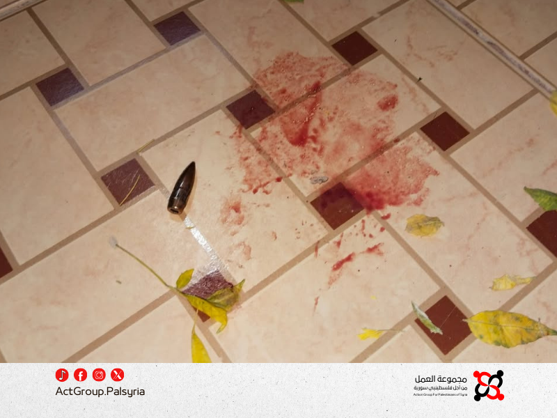 مخيم خان الشيح. إصابة طفلة بطلق ناري بسبب السلاح المنفلت  مجموعة العمل