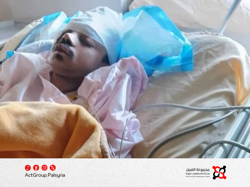 مخيم خان دنون. تحذيرات بعد إصابة شاب بحادث دراجة نارية