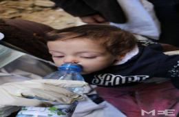مرض اليرقان يجتاح مخيم اليرموك المحاصر