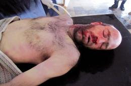 اغتيال " فراس الناجي " مسؤول مؤسسة بصمة في مخيم اليرموك المحاصر 