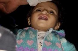 نقص الدواء يصيب طفلة بالجفاف في مخيم اليرموك المحاصر