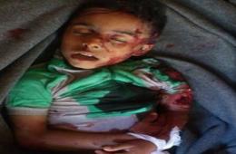 طفل فلسطيني يقضي إثر القصف على مخيم خان الشيح بريف دمشق 