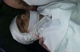 قضاء طفل فلسطيني ووقوع إصابات في قصف على مخيم درعا 