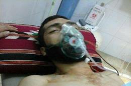 إصابة أحد أبناء مخيم درعا في اشتباكات المنشية جنوب سورية