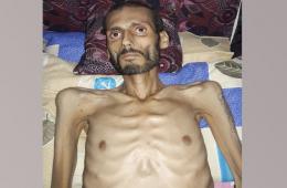 وفاة مريض فلسطيني بعد مناشدات عديدة لإخراجه من جنوب دمشق للعلاج