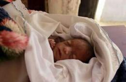 وفاة رضيع ثان خلال يومين بسبب الحصار ونقص الرعاية الصحية في مخيم اليرموك 