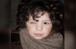أرملة فلسطينية تستغيث لعلاج ابنها الذي فقد إحدى عينيه