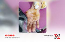 خطر المفرقعات النارية يهدد أطفال مخيم خان الشيح في رمضان