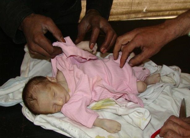 An Infant Died Due to Malnutrition and Lack of Medical Care because of the Yarmouk Camp Strict Siege.
