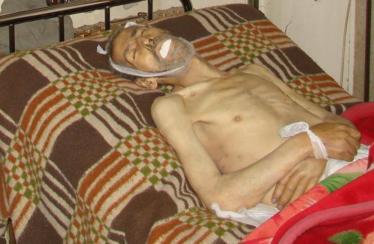 A Displaced Refugee from Yarmouk to Babila Dies due to Lack of Medical Care