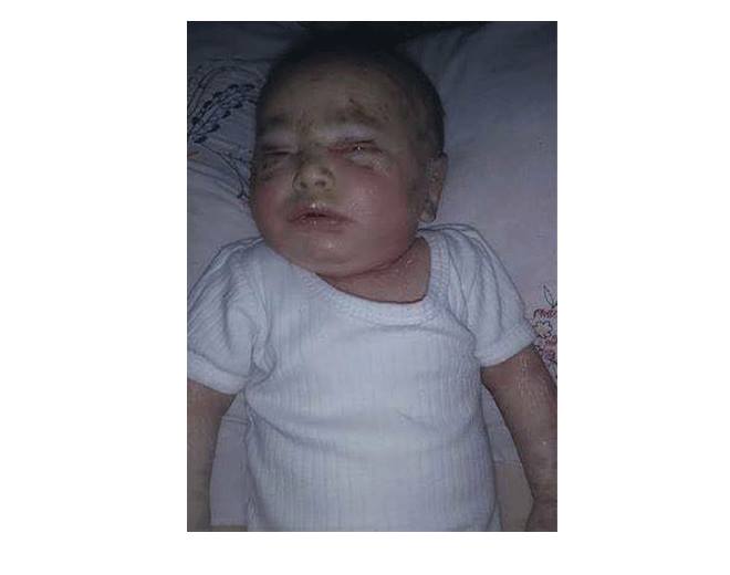 A Palestinian Baby Dies in Yarmouk due to Siege and Lack of Medical Care