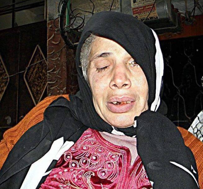 A Palestinian-Syrian refugee from Al-Yarmouk Camp dies.