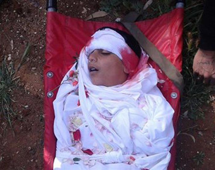 Over 76 Palestinian Children Killed by Shelling, Blockade on Yarmouk Camp