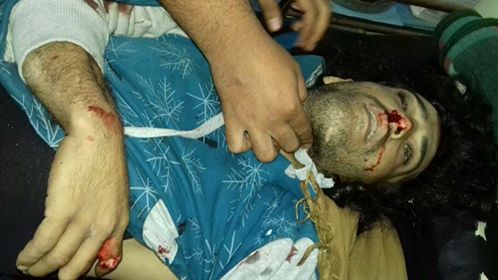 Palestinian man dies in Al-Muzayrib town, south of Syria
