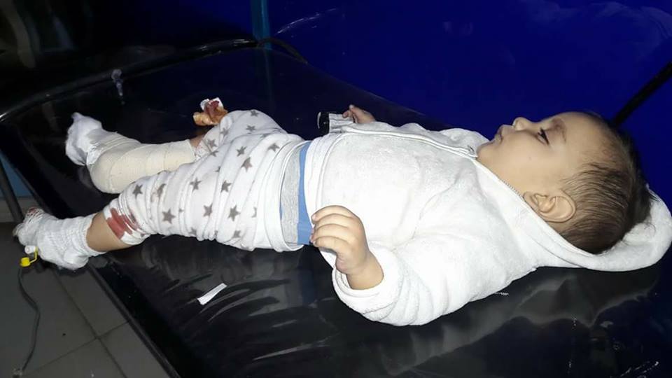 The infant “Adnan Awad Moussa” taken out of Yarmouk camp for treatment in Jaffa Hospital in Damascus