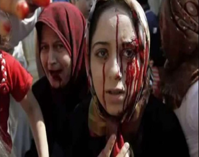 478 Palestinian Women, Girls Killed in War-Torn Syria