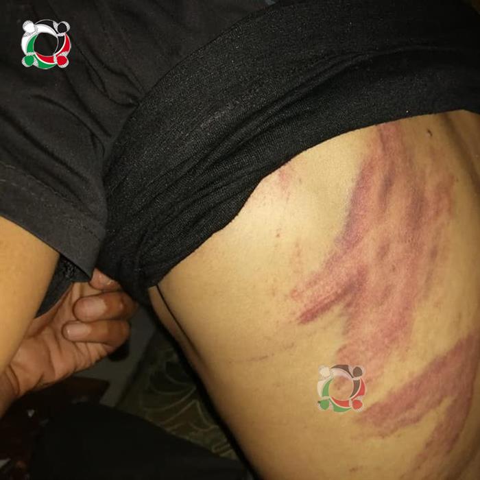 Palestinian Refugees from Syria Subjected to Heavy Beating by Turkish Border Police