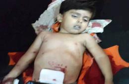A Child Dies by Shelling at the Yarmouk Camp
