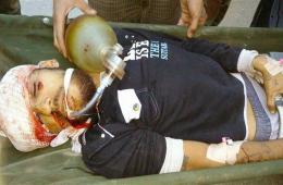 A Palestinian Refugee from Yarmouk Injured by a Sniper Shot at Yalda Town