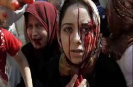 446 female PRS killed in Syria