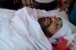 Assassination of the Relief Activist Bahaa Alameen in the Besieged Yarmouk Camp by Unknown Group